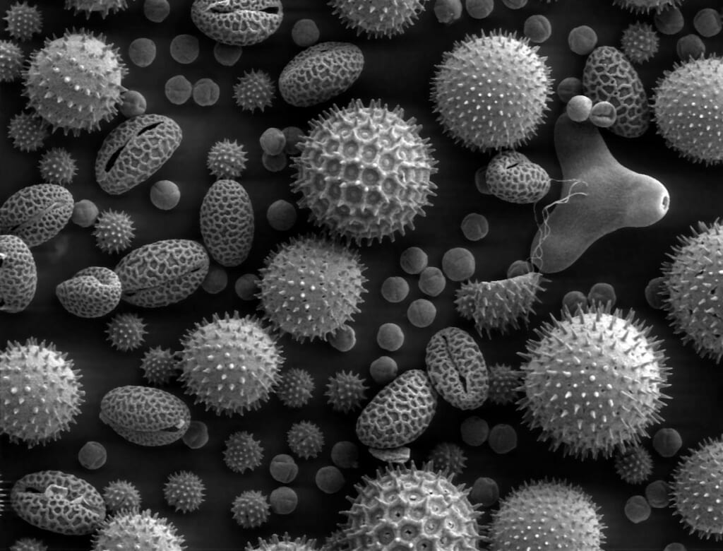 Misc pollen | オンザショア立川店 立川駅徒歩1分年中無休の溶岩ホットヨガスタジオ さまざまな植物の花粉を拡大し粒の形や表面の突起を色分けして示した写真 立川駅徒歩1分年中無休の溶岩ホットヨガスタジオ