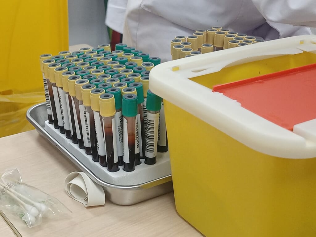 Blood test samples | オンザショア立川店 立川駅徒歩1分年中無休の溶岩ホットヨガスタジオ 血液検査のために採取された血液の検体検査に用いるサンプルを写した写真 立川駅徒歩1分年中無休の溶岩ホットヨガスタジオ