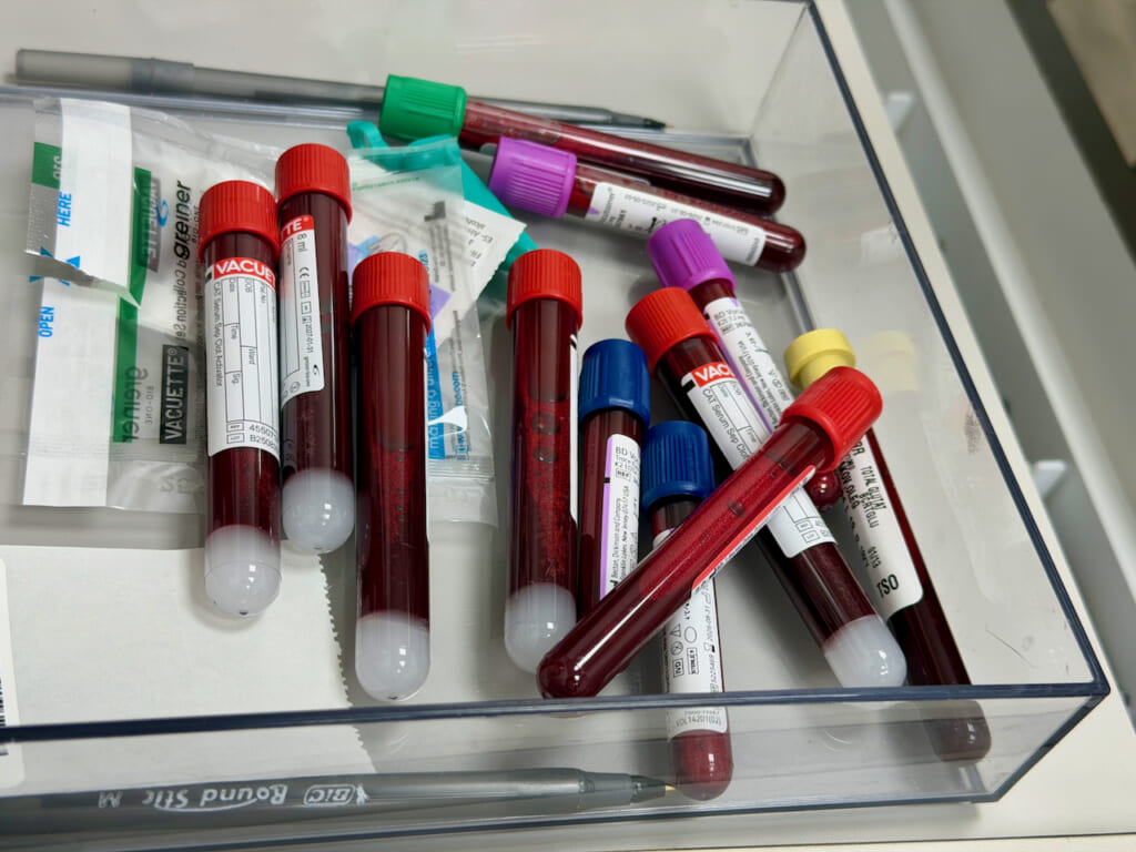 2026 Blood test samples | オンザショア立川店 立川駅徒歩1分年中無休の溶岩ホットヨガスタジオ 血液検査のための血液サンプル採取された血液を検体として写した写真 立川駅徒歩1分年中無休の溶岩ホットヨガスタジオ